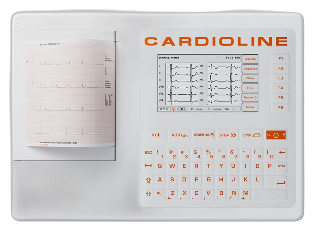 ECG100S